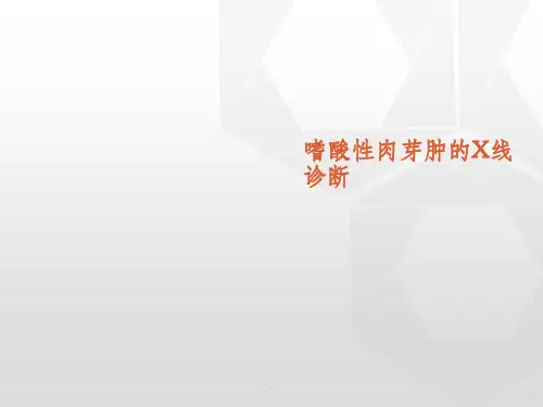 嗜酸性肉芽肿的影像表现