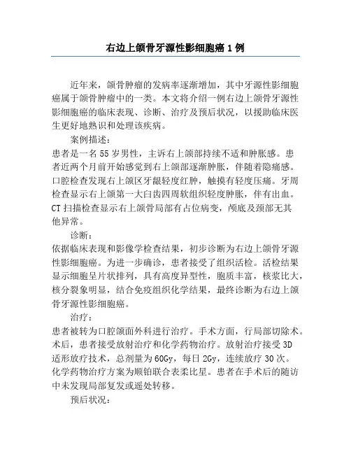 右侧上颌骨牙源性影细胞癌1例