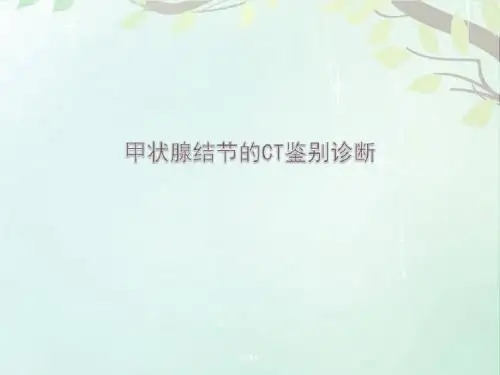 甲状腺结节的CT鉴别诊断  ppt课件