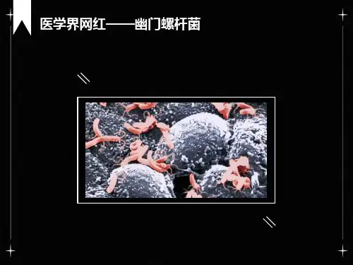 幽门螺杆菌检测方法