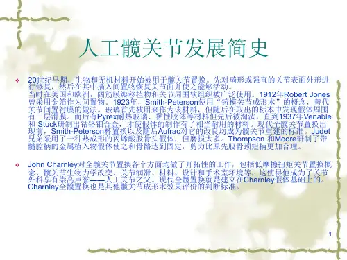 图解髋关节置换术【PPT】 