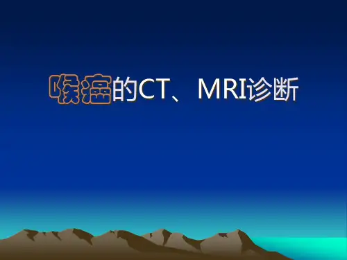 喉癌的CT、MRI诊断