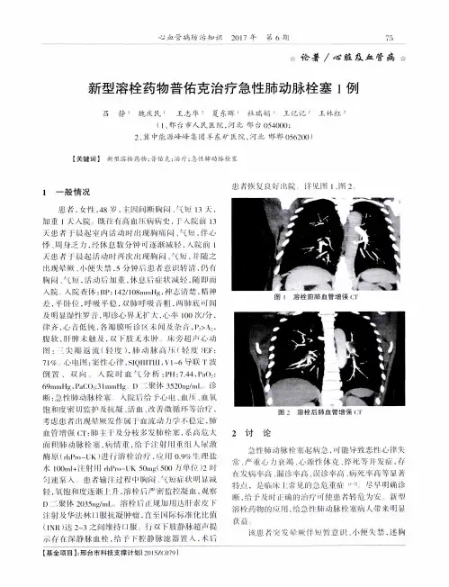 新型溶栓药物普佑克治疗急性肺动脉栓塞1例