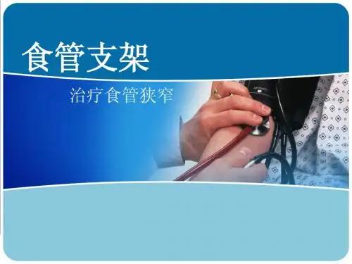 食管支架