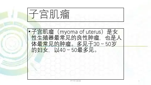 妇产科子宫肿瘤ppt课件