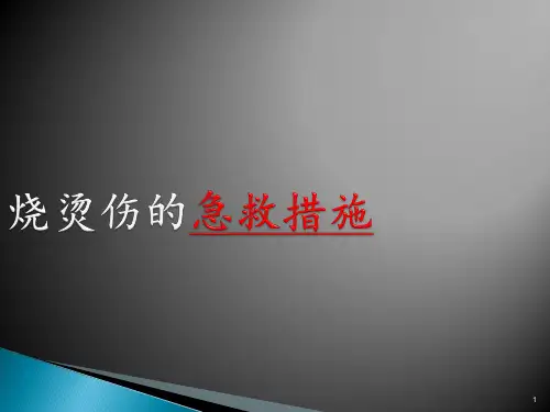 烫伤后的急救措施ppt课件