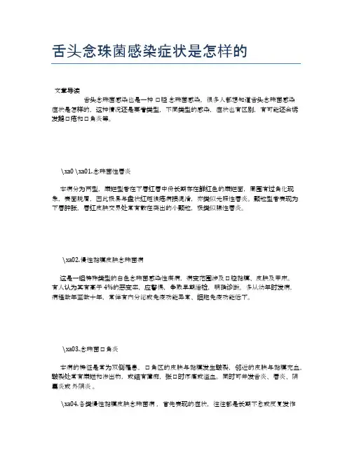 舌头念珠菌感染症状是怎样的【养生小知识】