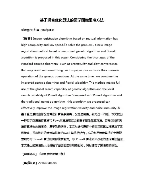 基于混合优化算法的医学图像配准方法