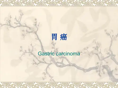 胃 癌 PPT课件