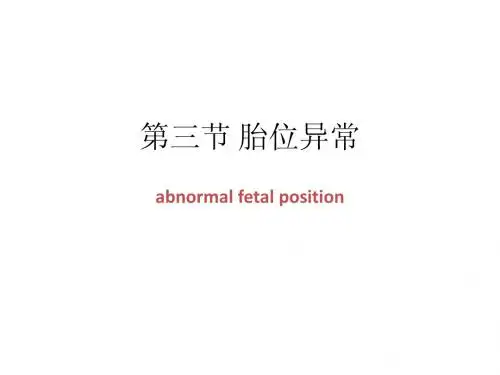 异常分娩-胎位异常