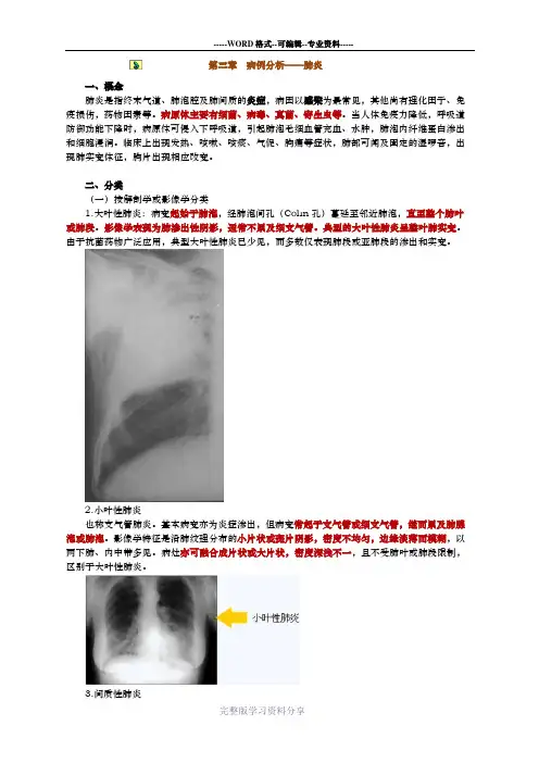 病例分析——肺炎