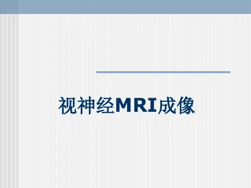 视神经MRI
