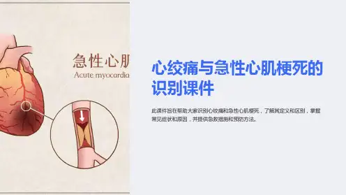 心绞痛与急性心肌梗死的识别课件
