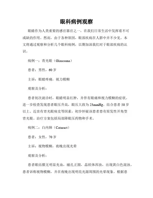 眼科病例观察