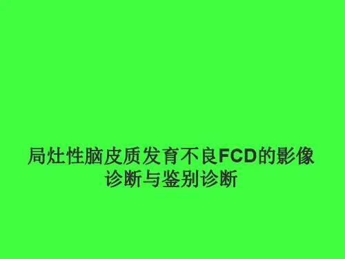 局灶性脑皮质发育不良FCD的影像诊断与鉴别诊断