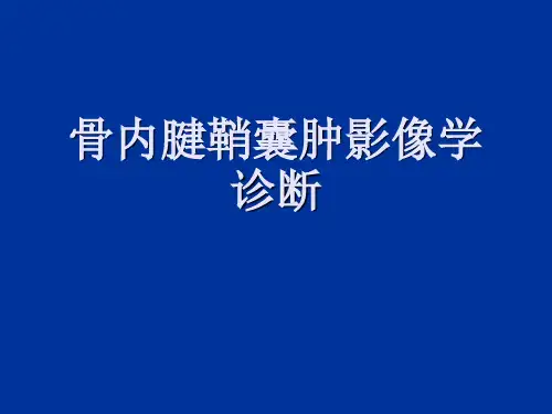 骨内腱鞘囊肿ppt课件
