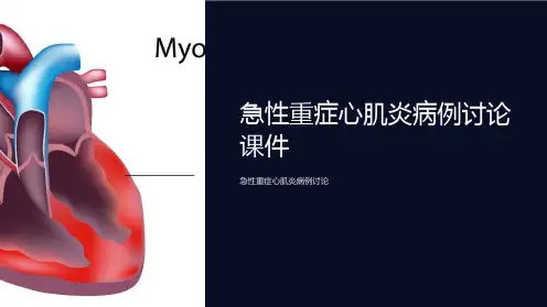急性重症心肌炎病例讨论课件