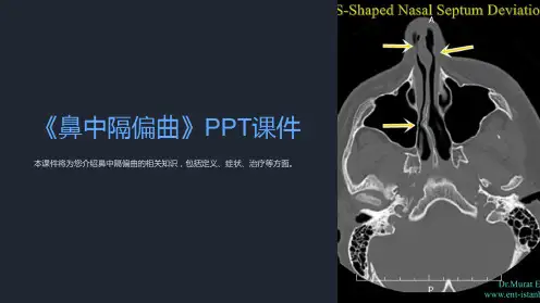 《鼻中隔偏曲》课件