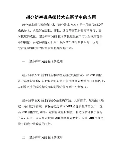 超分辨率磁共振技术在医学中的应用