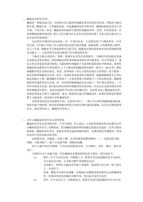 癫痫知识