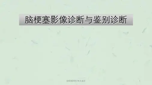 脑梗塞影像诊断及鉴别课件