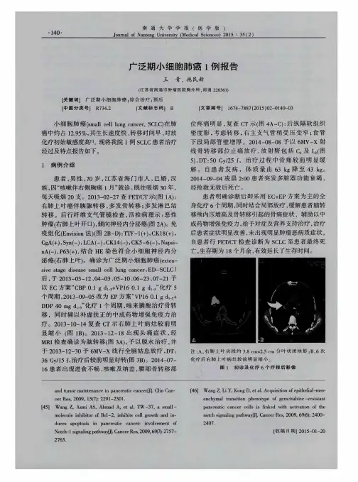 广泛期小细胞肺癌1例报告