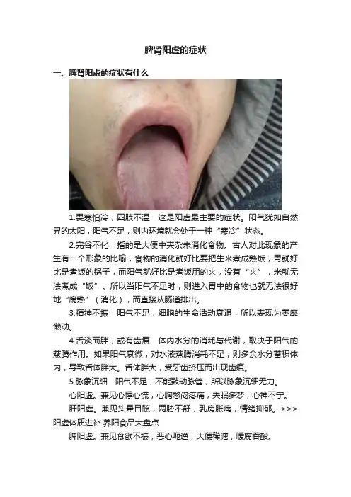 脾肾阳虚的症状