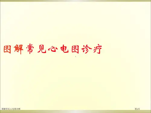 图解常见心电图诊断专家讲座