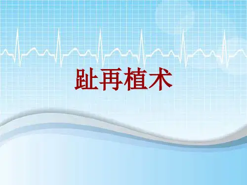 手术讲解模板：趾再植术