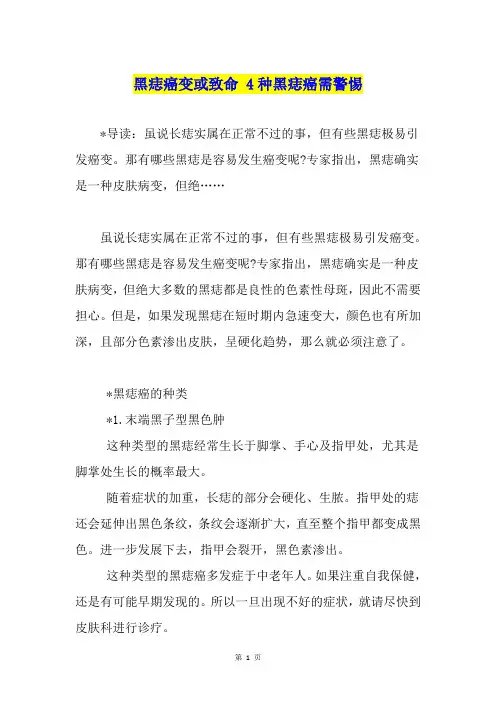 黑痣癌变或致命 4种黑痣癌需警惕