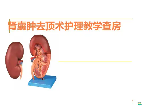 肾囊肿去顶术护理 ppt课件