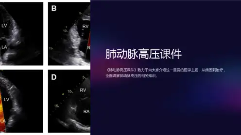 《肺动脉高压课件》