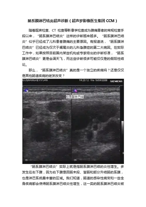 肠系膜淋巴结炎超声诊断（超声梦影像医生集团CCM）