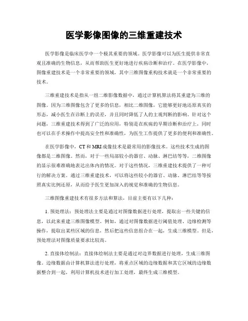 医学影像图像的三维重建技术