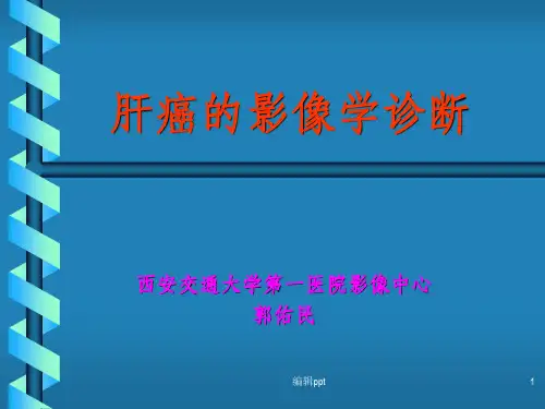 肝癌的影像学诊断