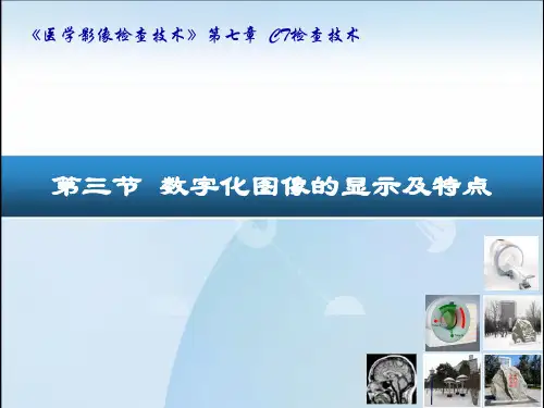医学影像检查技术课件：CT检查技术2