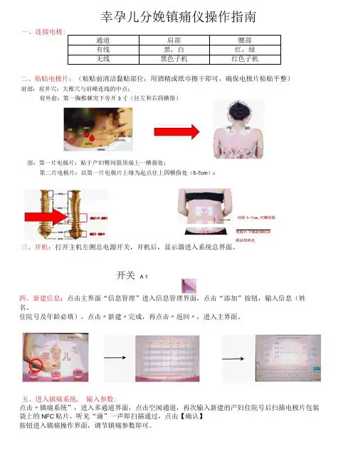 幸孕儿分娩镇痛仪操作指南