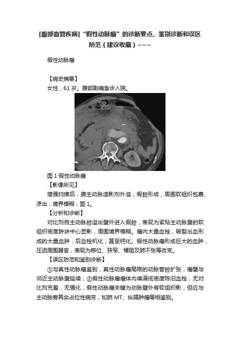 [腹部血管疾病]“假性动脉瘤”的诊断要点、鉴别诊断和误区防范（建议收藏）~~~