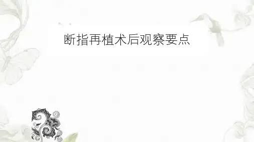 断指再植术后观察ppt课件