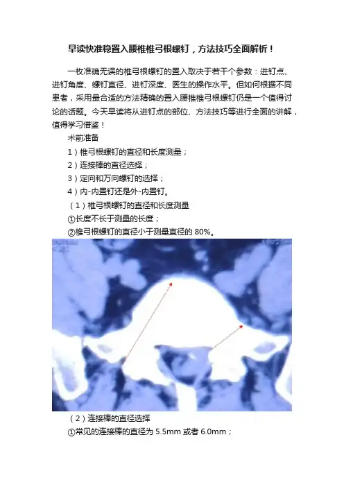 早读快准稳置入腰椎椎弓根螺钉，方法技巧全面解析！