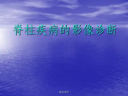 脊柱病变影像诊断ppt课件