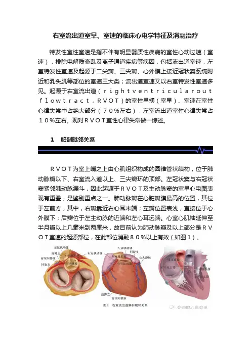 右室流出道室早、室速的临床心电学特征及消融治疗