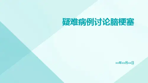 疑难病例讨论脑梗塞