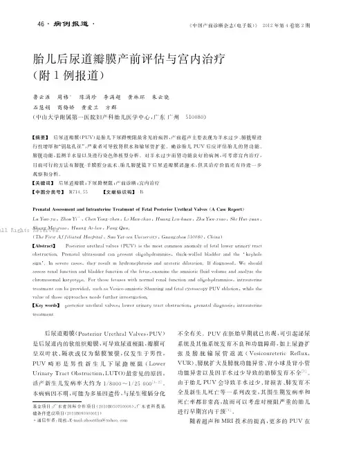 胎儿后尿道瓣膜产前评估与宫内治疗(附1例报道)