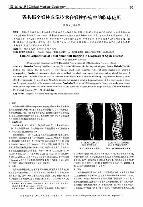 磁共振全脊柱成像技术在脊柱疾病中的临床应用