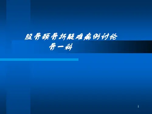 股骨颈骨折
