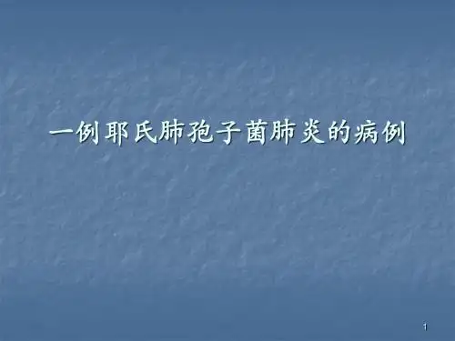 卡氏肺孢子菌肺炎病例汇报ppt课件