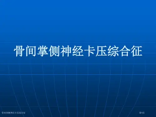 骨间掌侧神经卡压综合征