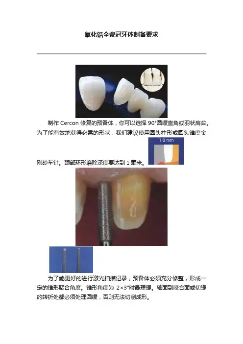 氧化锆全瓷冠牙体制备要求