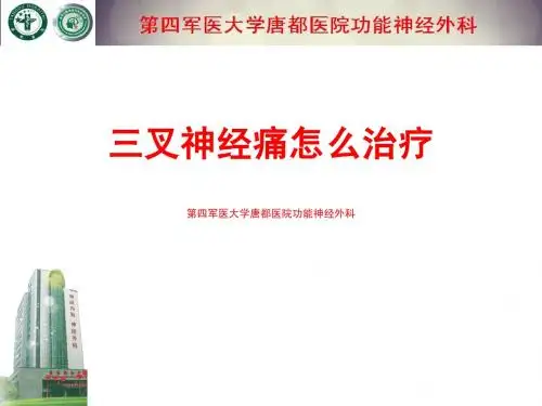 三叉神经痛怎么治疗